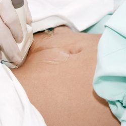 A hasi ultrahang vizsgálat menete
