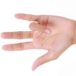 A pattanó ujj diagnózisa és kezelése