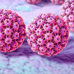 HPV tipizálás, a Humán Papillóma Vírus kimutatása